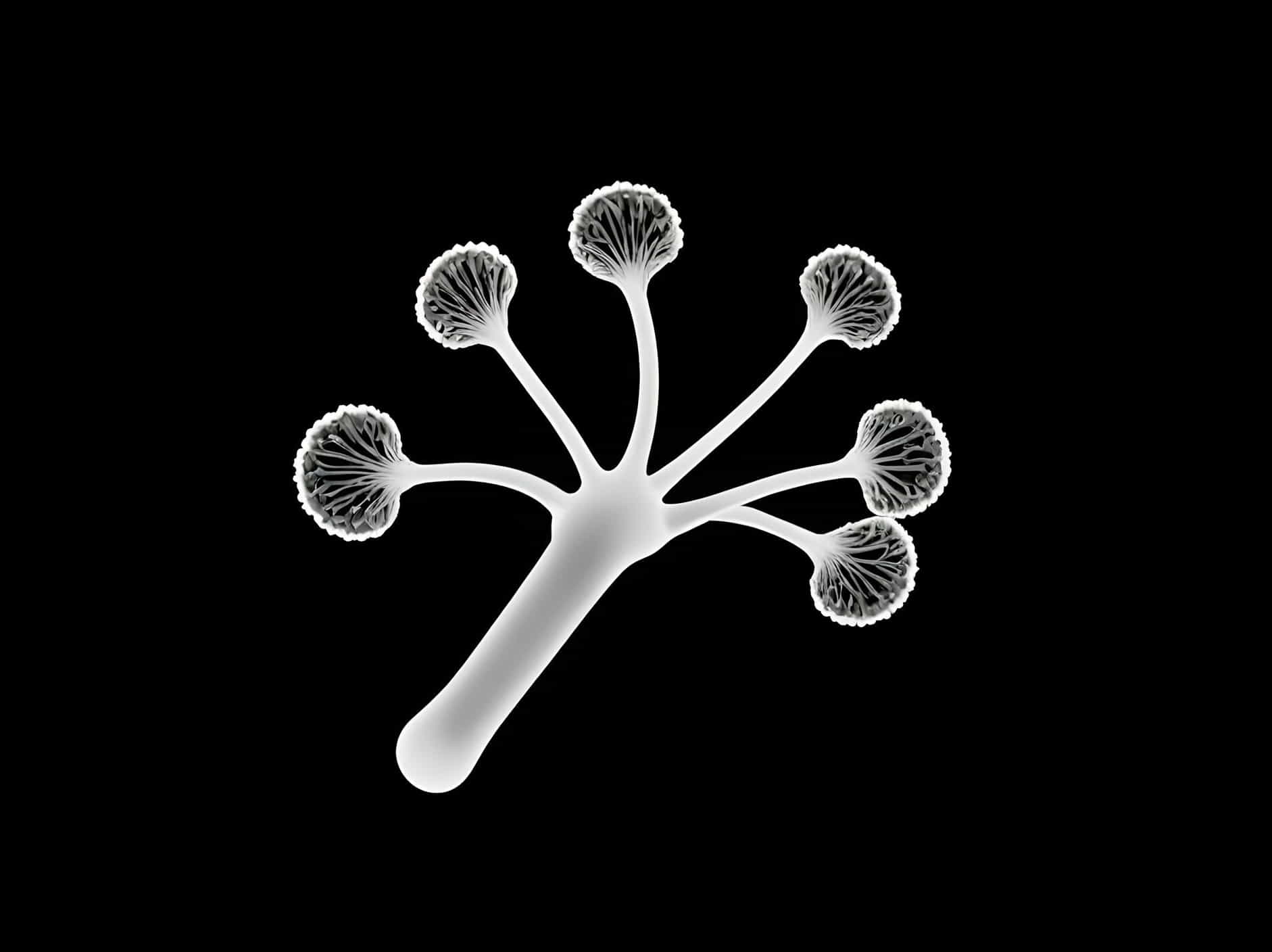 Does Aspergillus Show On X Ray