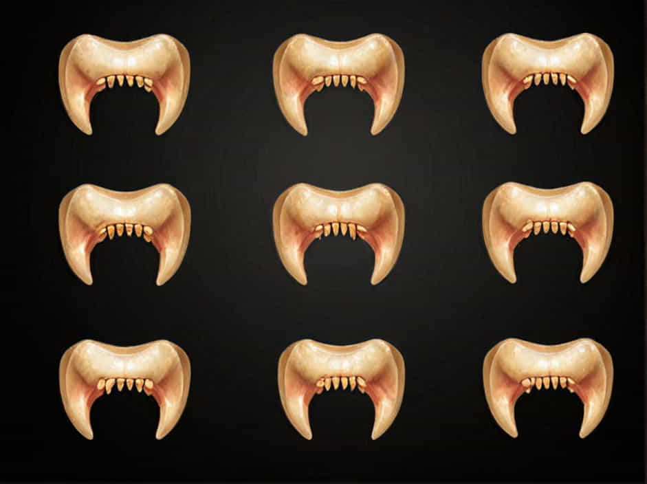 Type Of Bone In Maxilla And Mandible