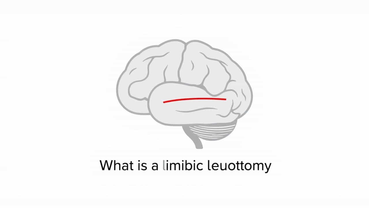 What Is A Limbic Leucotomy